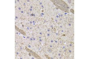 Immunohistochemistry of paraffin-embedded Mouse brain using CNP antibody at dilution of 1:100 (x400 lens). (Cnpase antibody)