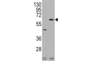 Western Blotting (WB) image for anti-V-Akt Murine Thymoma Viral Oncogene Homolog 3 (Protein Kinase B, Gamma) (AKT3) (AA 450-479) antibody (ABIN3029478)
