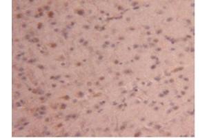 Detection of CPB2 in Mouse Brain Tissue using Polyclonal Antibody to Carboxypeptidase B2 (CPB2) (CPB2 antibody  (AA 187-327))