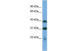 Host:  Rabbit  Target Name:  SLC1A6  Sample Type:  Jurkat Whole cell lysates  Antibody Dilution:  1. (SLC1A6 antibody  (C-Term))