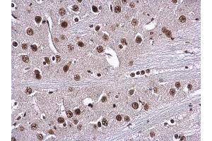 IHC-P Image RPA70 antibody [C1C3] detects RPA1 protein at nucleus in mouse brain by immunohistochemical analysis. (RPA1 antibody  (C-Term))