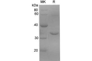 Western Blotting (WB) image for Kallikrein 10 (KLK10) protein (His tag) (ABIN7321289) (Kallikrein 10 Protein (KLK10) (His tag))