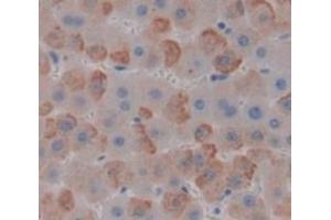 IHC-P analysis of Human Tissue, with DAB staining. (MYCBP antibody  (AA 2-103))
