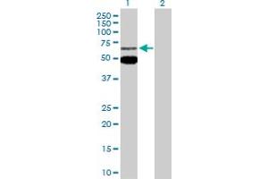 Western Blot analysis of MEF2C expression in transfected 293T cell line by MEF2C MaxPab polyclonal antibody. (MEF2C antibody  (AA 1-469))