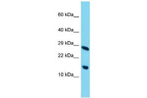 Host: Rabbit Target Name: C11orf52 Sample Type: HepG2 Whole Cell lysates Antibody Dilution: 1. (C11ORF52 antibody  (C-Term))