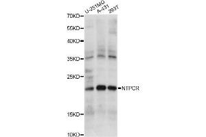 Western blot analysis of extracts of various cell lines, using NTPCR antibody (ABIN6292809) at 1:1000 dilution.