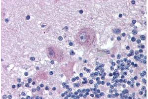 Human Brain, Cerebellum (formalin-fixed, paraffin-embedded) stained with SNX26 antibody ABIN290200 at 2. (SNX26 antibody  (AA 1113-1126))