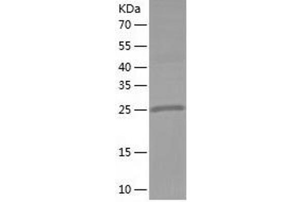 METTL1 Protein (AA 1-276) (His tag)