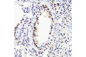 Immunohistochemistry of paraffin-embedded rat lung using EWSR1 Rabbit mAb (ABIN7267053) at dilution of 1:100 (40x lens). (EWSR1 antibody)