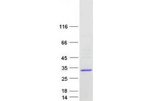 Calcium Binding Protein 2 (CABP2) (Transcript Variant 1) protein (Myc-DYKDDDDK Tag)
