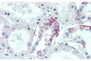 Detection of TMEM27 in Human Kidney Tissue using Polyclonal Antibody to Transmembrane Protein 27 (TMEM27) (TMEM27 antibody  (AA 15-141))