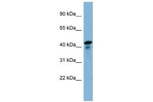 UEVLD antibody used at 1 ug/ml to detect target protein. (UEVLD antibody  (N-Term))
