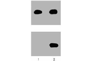 A431 cells were either left untreated (-) or treated (+) with 100 ng/ml EGF for 5 minutes at 37°C. (STAT5A antibody  (pTyr694))