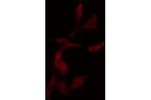 ABIN6275037 staining  HepG2 cells by IF/ICC. (NCAPG antibody  (C-Term))
