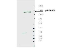 Western blot using  affinity purified anti-Spa310 antibody shows detection of endogenous pRb2/p130 protein in whole LNCaP cell extracts. (p130 antibody)