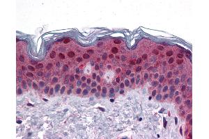 Anti-FAM120B antibody IHC of human skin. (FAM120B antibody  (C-Term))