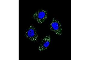 Confocal immunofluorescent analysis of EDN1 Antibody (Center)  with A549 cell followed by Alexa Fluor 488-conjugated goat anti-rabbit lgG (green). (Endothelin 1 antibody  (Center))