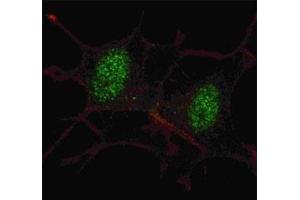Immunofluorescence (IF) image for anti-SMAD, Mothers Against DPP Homolog 2 (SMAD2) (AA 97-125) antibody (ABIN3032613)