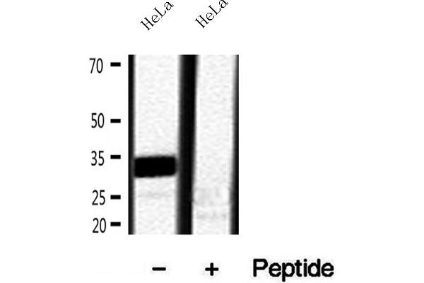Ribonuclease H1 antibody  (Internal Region)