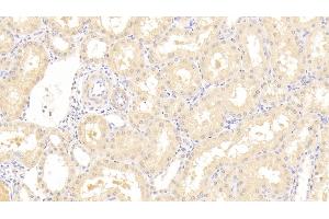Detection of SPHK1 in Human Kidney Tissue using Polyclonal Antibody to Sphingosine Kinase 1 (SPHK1) (SPHK1 antibody  (AA 148-398))