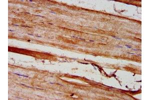 IHC image of ABIN7154448 diluted at 1:300 and staining in paraffin-embedded human skeletal muscle tissue performed on a Leica BondTM system. (GREM1 antibody  (AA 18-184))