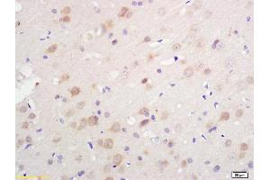 Formalin-fixed and paraffin embedded rat brain tissue labeled with Anti S-100/S100A1 Polyclonal Antibody, Unconjugated (ABIN728983) at 1:200 followed by conjugation to the secondary antibody and DAB staining. (S100A1 antibody)
