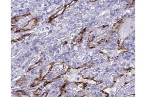ABIN6268712 at 1/100 staining human lung tissues sections by IHC-P.