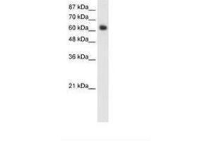 Image no. 1 for anti-Forkhead Box G1 (FOXG1) (C-Term) antibody (ABIN202649) (FOXG1 antibody  (C-Term))