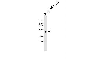 Anti-WIF1 Antibody (Human C-term) at 1:2000 dilution + Human skeletal muscle lysate Lysates/proteins at 20 μg per lane. (WIF1 antibody  (C-Term))