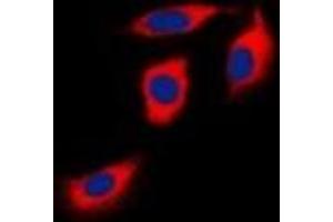 Immunofluorescent analysis of EPHA1 staining in Hela cells. (EPHA1 antibody)