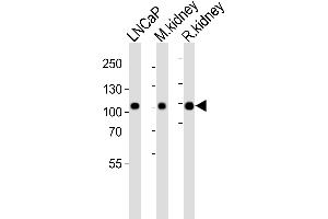 Western blot analysis of lysates from LNCaP cell line, mouse kidney, rat kidney tissue lysate(from left to right), using E Antibody (Center) (ABIN6243088 and ABIN6577473). (MME antibody  (AA 492-525))