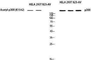 Western Blot (WB) analysis of HeLa 293T 823-AV using EP300 antibody.
