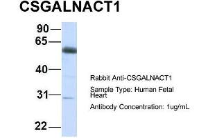 Host:  Rabbit  Target Name:  CSGALNACT1  Sample Type:  Human Fetal Heart  Antibody Dilution:  1.
