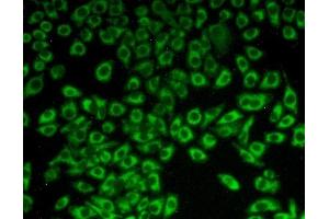 Detection of C1QBP in Hela cells using Polyclonal Antibody to Complement component 1 Q subcomponent-binding protein, mitochondrial (C1QBP) (C1QBP antibody  (AA 71-278))