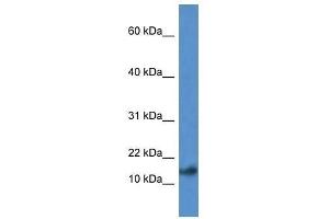 Western Blot showing Psenen antibody used at a concentration of 1.