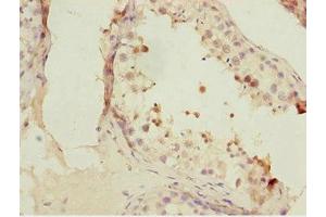 Immunohistochemistry of paraffin-embedded human testis tissue using ABIN7153074 at dilution of 1:100 (FOXN2 antibody  (AA 172-431))