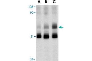 Western blot analysis of BIRC2 in human lung tissue lysate with BIRC2 polyclonal antibody  at 1 (lane A), 2 (lane B), and 4 (lane C) ug/mL , respectively.