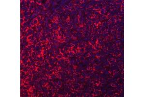 IF analysis of ACAD9 using anti-ACAD9 antibody (ABIN7602670). (ACAD9 antibody  (AA 92-621))