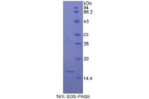 SDS-PAGE (SDS) image for Transforming Growth Factor, beta 1 (TGFB1) (AA 279-390) protein (His tag) (ABIN1081008)