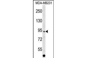 ALS2CL Antibody (Center) (ABIN1538341 and ABIN2849165) western blot analysis in MDA-M cell line lysates (35 μg/lane). (ALS2CL antibody  (AA 349-377))