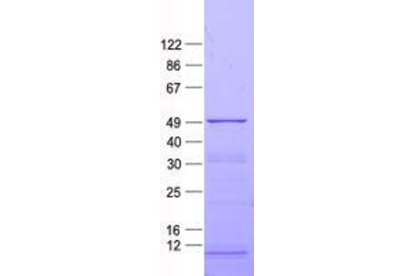 ZNF114 Protein (His tag)