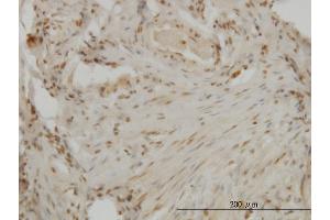 Immunoperoxidase of monoclonal antibody to DLX2 on formalin-fixed paraffin-embedded human ovary. (DLX2 antibody  (AA 1-110))