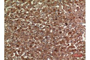 Immunohistochemistry (IHC) analysis of paraffin-embedded Human Liver, antibody was diluted at 1:100.