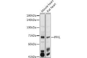Western blot analysis of extracts of various cell lines, using PFKL antibody (ABIN7269308) at 1:1000 dilution. (PFKL antibody  (AA 700-780))