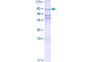 GGT5 Protein (AA 1-587) (GST tag)