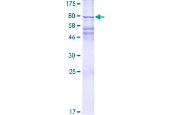 GGT5 Protein (AA 1-587) (GST tag)