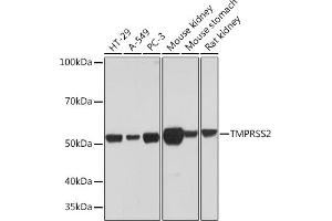 Western blot analysis of extracts of various cell lines, using TMPRSS2 Rabbit mAb (ABIN7270946) at 1:1000 dilution. (TMPRSS2 antibody)