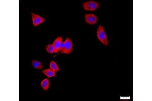 HeLa cells were stained with AQP1 Polyclonal Antibody, Unconjugated at 1:500 in PBS and incubated for two hours at 37°C followed by Goat Anti-Rabbit IgG (H+L) Cy3 conjugated secondary antibody. (Aquaporin 1 antibody  (AA 181-269))