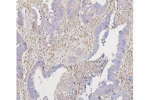 IHC analysis of Collagen III/COL3A1 using anti-Collagen III/COL3A1 antibody (ABIN6719296).
