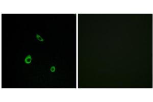 Immunofluorescence analysis of LOVO cells, using MAPK15 antibody. (MAPK15 antibody  (Internal Region))